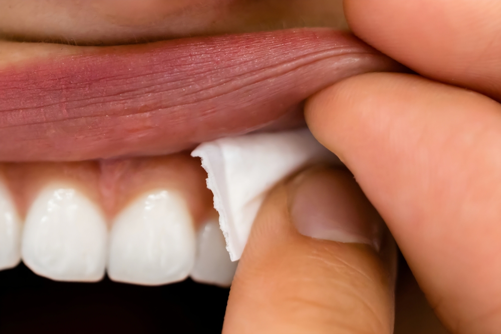 Zyn Nicotine Pouches and Your Oral Health